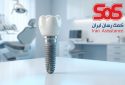 ایمپلنت دندان با بیمه تکمیلی SOS