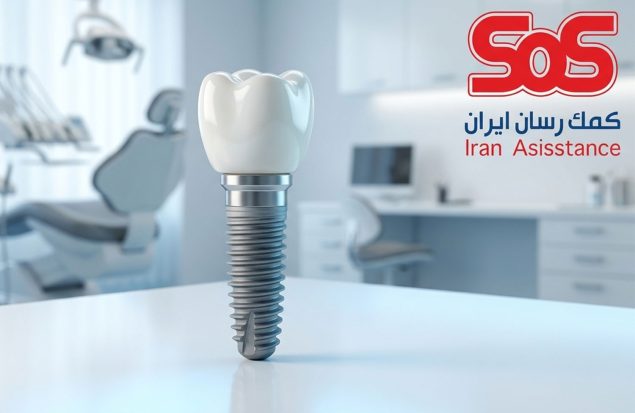 ایمپلنت دندان با بیمه تکمیلی SOS